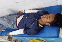 ठाकुरद्वारा फ्लाईओवर स्टंट बाजी ने दो युवकों को पहुुंचाया आईसीयू